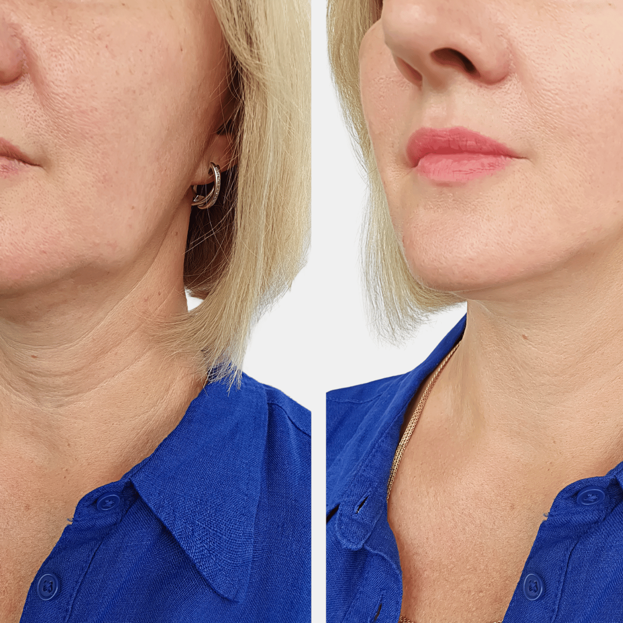 Anti Aging Cream