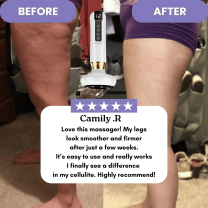 Yorra Anti Cellulite Massager